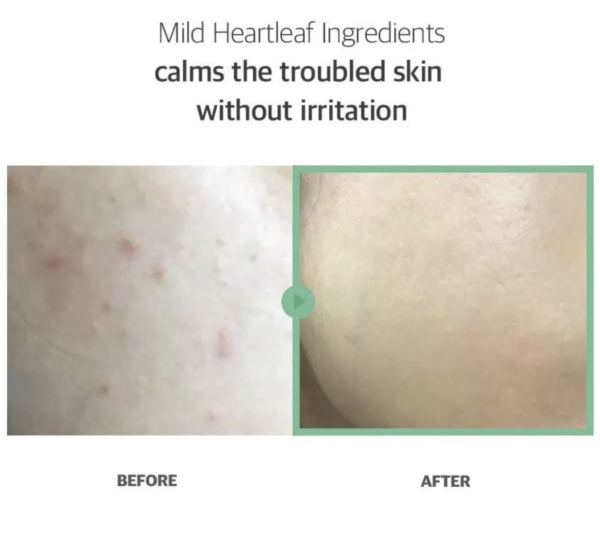 Heartleaf BHA Peeling Pad – Image 7