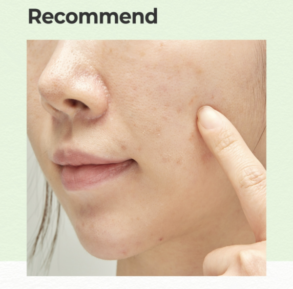 AHA.BHA.PHA 30 Days Miracle Serum Light – Image 4
