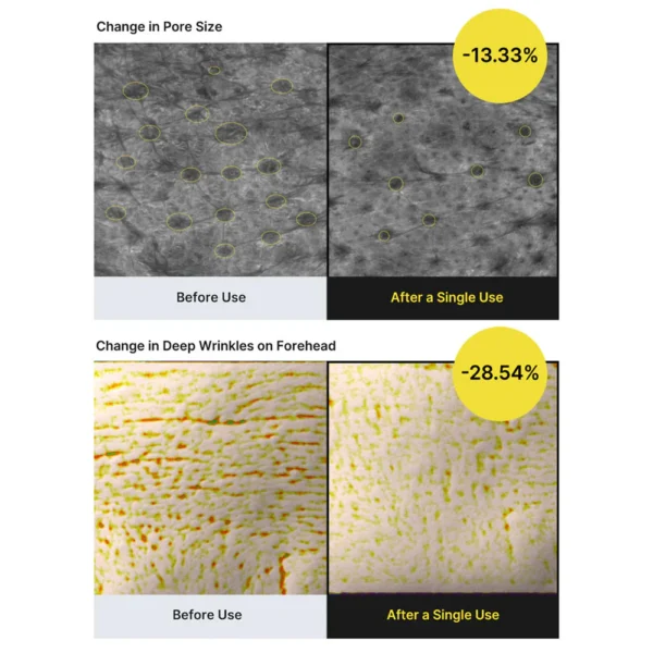 THE -A Retinal Shot Tightening Booster – Image 4