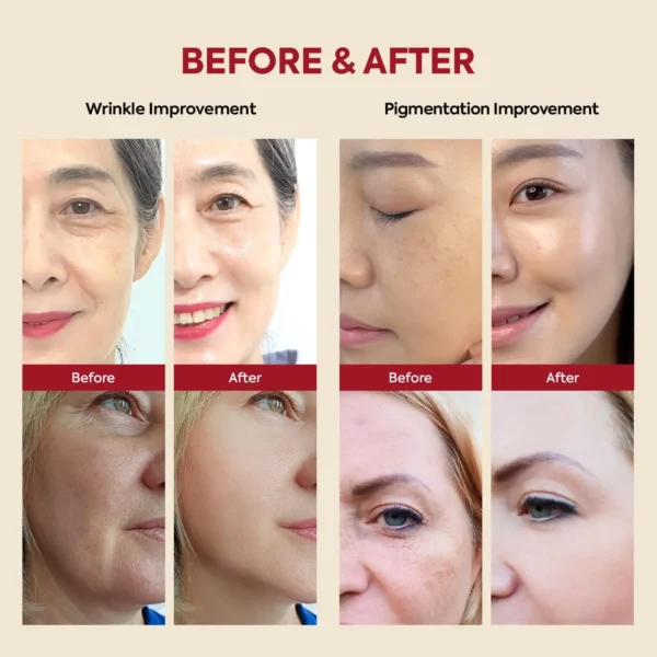 SEOUL 1988 Serum : Retinal Liposome 2% + Black Ginseng – Image 4