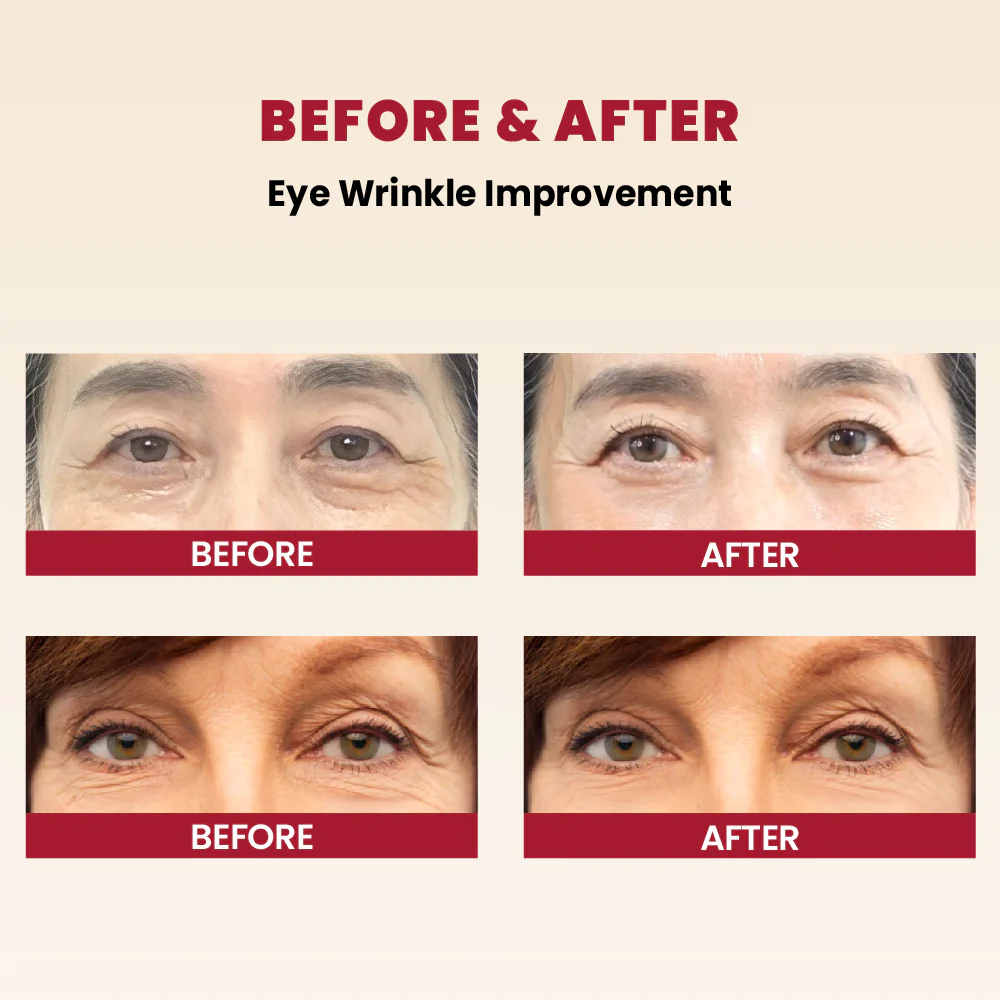 KSECRET SEOUL 1988 Eye Cream : Retinal Liposome 4% + Fermented Bean