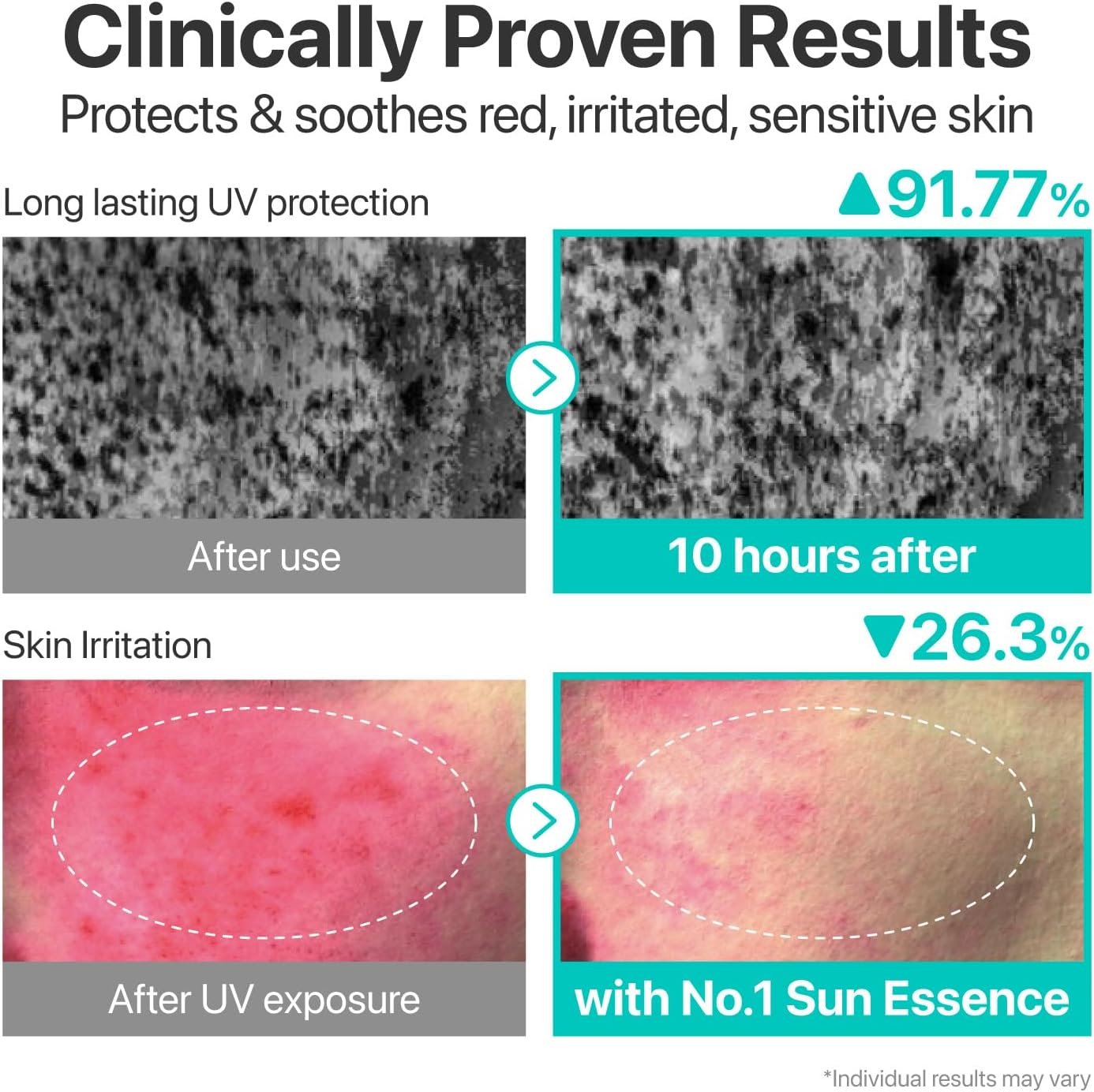 No.1 Clear Filter Sun Essence SPF50+ PA++++ – Image 7